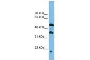 Image no. 1 for anti-Chromosome 11 Open Reading Frame 73 (C11orf73) (C-Term) antibody (ABIN6745127) (C11orf73 抗体  (C-Term))