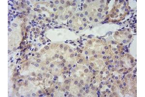 Immunohistochemistry (IHC) image for anti-Peripheral-Type Benzodiazepine Receptor (TSPO) (C-Term) antibody (ABIN570960)