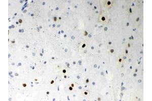 Anti- SF2 Picoband antibody,  IHC(P)IHC(P): Rat Brain Tissue (SRSF1 抗体  (N-Term))