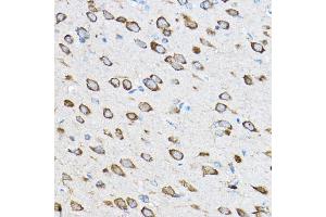 Immunohistochemistry (IHC) image for anti-Ribosomal Protein L23 (RPL23) (AA 1-140) antibody (ABIN1682575)