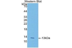 Western Blotting (WB) image for anti-Lysyl Oxidase-Like 2 (LOXL2) (AA 53-160) antibody (ABIN1176463) (LOXL2 抗体  (AA 53-160))
