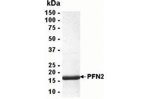 Western Blotting (WB) image for Profilin 2 (PFN2) (AA 1-140) protein (ABIN2468972)