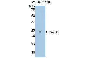 Western blot analysis of the recombinant protein. (ICAM4 抗体  (AA 52-234))