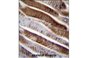 ETFA Antibody (C-term) (ABIN655079 and ABIN2844711) immunohistochemistry analysis in formalin fixed and paraffin embedded human skeletal muscle followed by peroxidase conjugation of the secondary antibody and DAB staining. (ETFA 抗体  (C-Term))