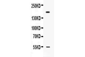 Western blot analysis of Collagen I expression in MCF-7 whole cell lysates ( Lane 1). (COL1A1 抗体  (C-Term))