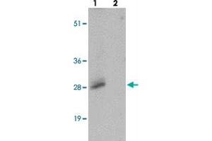 Western blot analysis of SHISA3 in human small intestine tissue with SHISA3 polyclonal antibody  at 1 ug/mL in (lane 1) the absence and (lane 2) the presence of blocking peptide. (SHISA3 抗体  (Internal Region))