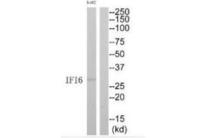 Western blot analysis of extracts from K562 cells, using IFI6 antibody. (IFI6 抗体  (C-Term))