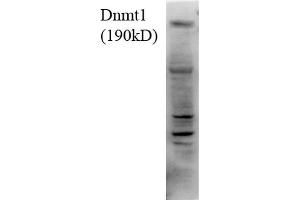 Western Blot analysis of Human H1299 cell lysate showing detection of DNMT1 protein using Mouse Anti-DNMT1 Monoclonal Antibody, Clone 4G11-C7 . (DNMT1 抗体  (AA 620-950) (APC))
