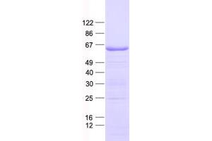 Western Blotting (WB) image for Spermatogenesis Associated 16 (SPATA16) protein (His tag) (ABIN2732513)