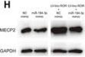 linc-ROR promoted cell proliferation, migration, and invasion of breast cancer through linc-ROR/miR-194-3p/MECP2 regulatory axis. (MECP2 抗体  (AA 1-100))
