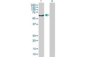 Western Blot analysis of NARS expression in transfected 293T cell line by NARS MaxPab polyclonal antibody. (NARS 抗体  (AA 1-548))