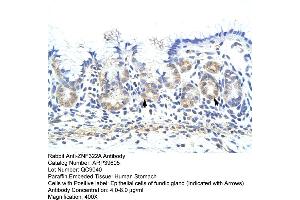 Human Stomach (ZNF322A 抗体  (C-Term))