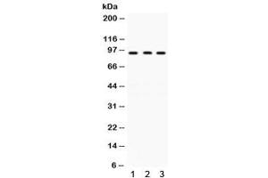 Western blot testing of human 1) A431, 2) 22RV1 and 3) COLO320 lysate with GCN5 antibody. (KAT2A 抗体)
