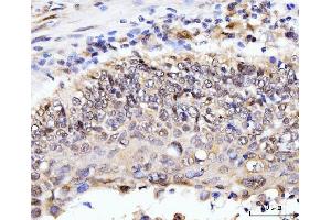 IHC analysis of AKAP 95/AKAP8 using anti-AKAP 95/AKAP8 antibody (ABIN7601553).