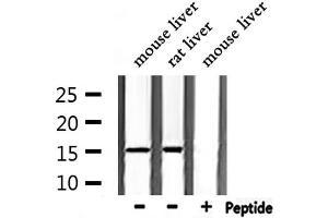 Western blot analysis of extracts from mouse liver,rat liver, using TAC1  Antibody. (TAC1 抗体  (N-Term))