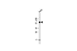 Anti-SMOC1 Antibody (C-term) at 1:2000 dilution + Hela whole cell lysate Lysates/proteins at 20 μg per lane.