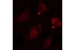ABIN6274582 staining HepG2 cells by IF/ICC. (ADD3 抗体  (Internal Region))