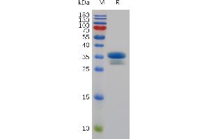 Mouse TweakR Protein, hFc Tag on SDS-PAGE under reducing condition.