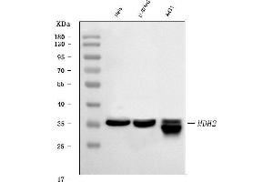 Western blot analysis of MDH2 using anti-MDH2 antibody (ABIN7602617).