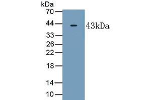 Detection of Recombinant RAMP2, Human using Polyclonal Antibody to Receptor Activity Modifying Protein 2 (RAMP2) (RAMP2 抗体  (AA 43-145))