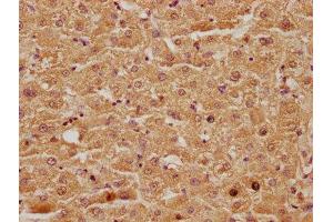 IHC image of ABIN7146081 diluted at 1:100 and staining in paraffin-embedded human liver tissue performed on a Leica BondTM system.