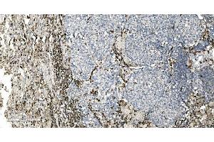 IHC analysis of Coronin 1a/TACO/CORO1A using anti-Coronin 1a/TACO/CORO1A antibody (ABIN7600292).