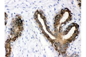 Immunohistochemistry (Paraffin-embedded Sections) (IHC (p)) image for anti-Keratin 19 (KRT19) (AA 334-372), (C-Term) antibody (ABIN3043288)