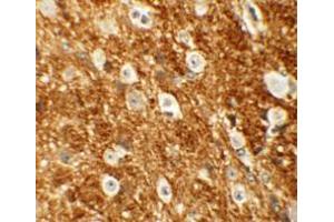 Immunohistochemistry (IHC) image for anti-rho-Associated, Coiled-Coil Containing Protein Kinase 2 (ROCK2) (Middle Region) antibody (ABIN1031072) (ROCK2 抗体  (Middle Region))