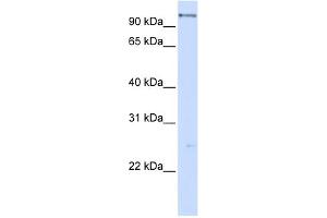 WB Suggested Anti-DHX15 Antibody Titration:  0. (DHX15 抗体  (C-Term))