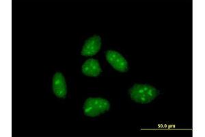 Immunofluorescence of purified MaxPab antibody to CRI1 on HeLa cell. (EID1 抗体  (AA 1-187))