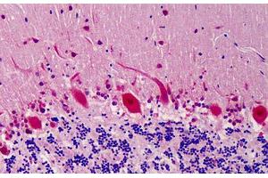 Human Brain: Formalin-Fixed, Paraffin-Embedded (FFPE) (COPS5 抗体)