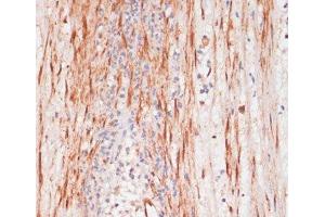 Immunohistochemistry of paraffin-embedded Human appendix using Phospho-PEA15(S104) Polyclonal Antibody at dilution of 1:100 (40x lens). (PEA15 抗体  (pSer104))