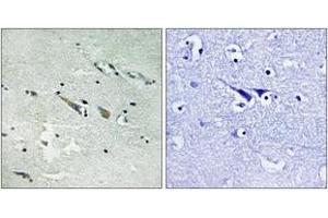 Immunohistochemistry (IHC) image for anti-V-Raf-1 Murine Leukemia Viral Oncogene Homolog 1 (RAF1) (AA 251-300) antibody (ABIN2889118) (RAF1 抗体  (AA 251-300))