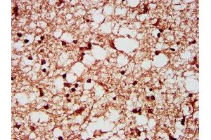 IHC image of ABIN7170618 diluted at 1:200 and staining in paraffin-embedded human brain tissue performed on a Leica BondTM system. (SF3B1 抗体  (AA 186-378))