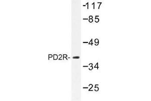 Image no. 1 for anti-Prostaglandin D2 Receptor (PTGDR) antibody (ABIN317875) (PTGDR 抗体)
