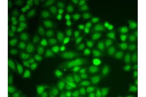 Immunofluorescence analysis of A549 cells using PYCARD antibody (ABIN4904914). (PYCARD 抗体)