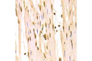 Immunohistochemistry of paraffin-embedded human esophagus using SFN Antibody. (14-3-3 sigma/SFN 抗体  (AA 1-248))