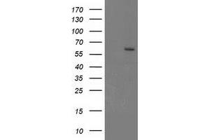 Image no. 1 for anti-Cytochrome P450, Family 17, Subfamily A, Polypeptide 1 (CYP17A1) antibody (ABIN1497704) (CYP17A1 抗体)