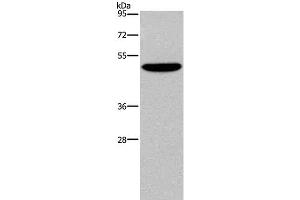 Western Blot analysis of SKOV3 cell using NECTIN4 Polyclonal Antibody at dilution of 1:350 (PVRL4 抗体)