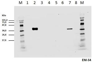 Cell lyzates of HEK293T/17 cells transiently transfected with expression vectors harboring genes for mCD3zeta wild type and six different mCD3zeta mutants, where particular ITAM tyrosines were substituted with phenylalanines, were prepared. (CD247 抗体  (pTyr142))