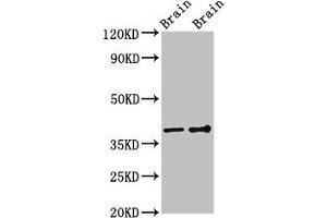 Western Blot Positive WB detected in: Rat brain tissue, Mouse brain tissue All lanes: GNB1 antibody at 3 μg/mL Secondary Goat polyclonal to rabbit IgG at 1/50000 dilution Predicted band size: 38, 37 kDa Observed band size: 38 kDa (GNB1 抗体  (AA 157-248))