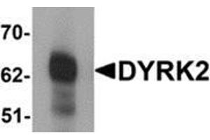 Western blot analysis of DYRK2 in 293 cell lysate with DYRK2 antibody at (A) 1 and (B) 2 μg/ml.