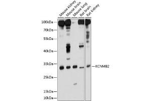 Western blot analysis of extracts of various cell lines, using KCNMB2 antibody (ABIN6129436, ABIN6142762, ABIN6142763 and ABIN6214468) at 1:1000 dilution.