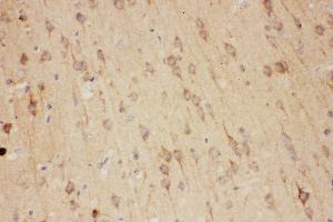 Anti-RTN3 antibody, IHC(P) IHC(P): Rat Brain Tissue (Reticulon 3 抗体  (C-Term))