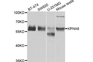 Western blot analysis of extracts of various cell lines, using KPNA6 antibody (ABIN5975280) at 1/1000 dilution. (KPNA6 抗体)