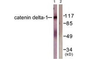 Western blot analysis of extracts from HuvEc cells, using Catenin-delta1 (Ab-228) Antibody. (CTNND1 抗体  (AA 201-250))