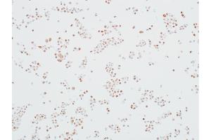 Immunocytochemistry (ICC) image for anti-Mediator Complex Subunit 12 (MED12) (AA 2127-2177) antibody (ABIN7453977) (Recombinant MED12 抗体  (AA 2127-2177))