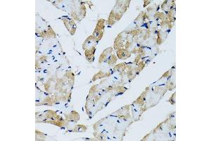 Immunohistochemistry of paraffin-embedded rat heart using GABARAP antibody. (GABARAP 抗体  (AA 1-100))