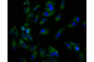 Immunofluorescence staining of Hela cells with ABIN7167082 at 1:166, counter-stained with DAPI. (REPS1 抗体  (AA 105-230))