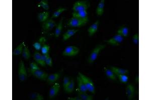 Immunofluorescence staining of Hela cells with ABIN7167082 at 1:166, counter-stained with DAPI.